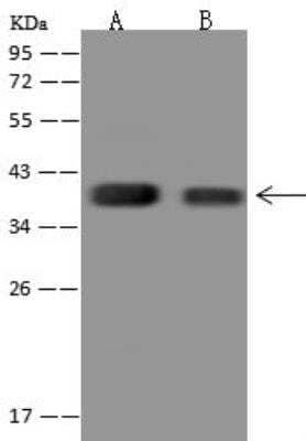 Western Blot: C1orf198 Antibody [NBP3-12665]