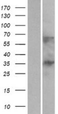 Western Blot: C1orf198 Overexpression Lysate [NBP2-05938]