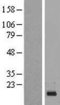 Western Blot: PIG13 Overexpression Lysate [NBL1-08311]