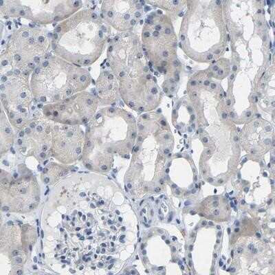 Immunohistochemistry-Paraffin: TEMP Antibody [NBP1-81061]