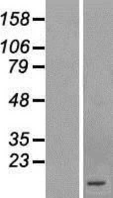 Western Blot: TEMP Overexpression Lysate [NBL1-08312]