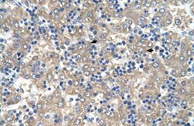 Immunohistochemistry-Paraffin: BRICK1 Antibody [NBP1-56944]