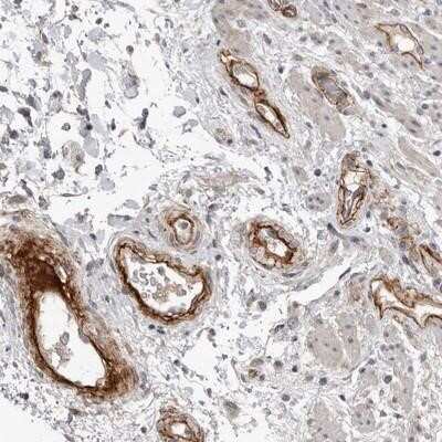 Immunohistochemistry-Paraffin: C1orf216 Antibody [NBP1-83469]