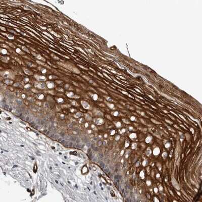 Immunohistochemistry-Paraffin: C1orf216 Antibody [NBP1-83469]