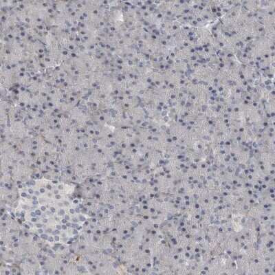 Immunohistochemistry-Paraffin: C1orf216 Antibody [NBP1-83469]