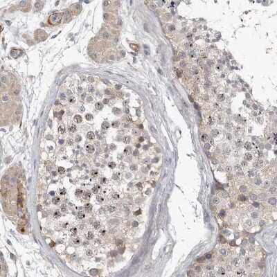 Immunohistochemistry-Paraffin: C1orf216 Antibody [NBP1-83469]