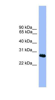 Western Blot: C1orf216 Antibody [NBP1-69165]