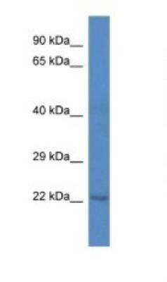 Western Blot: C1orf216 Antibody [NBP1-74251]