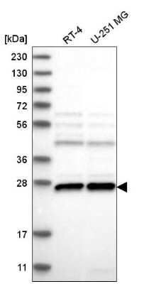 Western Blot: C1orf216 Antibody [NBP2-58717]