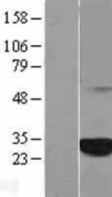 Western Blot: C1orf216 Overexpression Lysate [NBL1-08313]