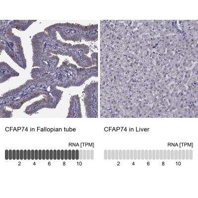Immunohistochemistry: CFAP74 Antibody [NBP1-90919]