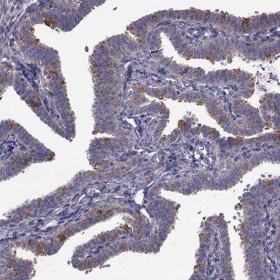 Immunohistochemistry-Paraffin: CFAP74 Antibody [NBP1-90919]