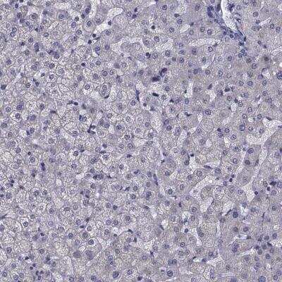 Immunohistochemistry-Paraffin: CFAP74 Antibody [NBP1-90919]