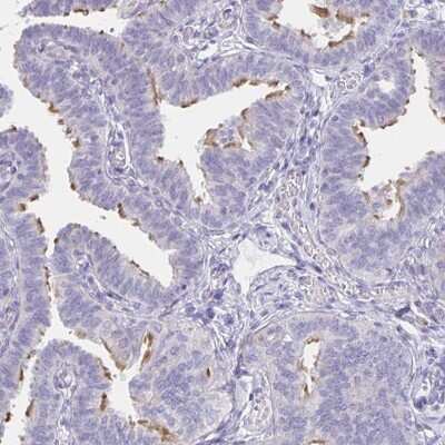 Immunohistochemistry-Paraffin: CFAP74 Antibody [NBP1-90921]