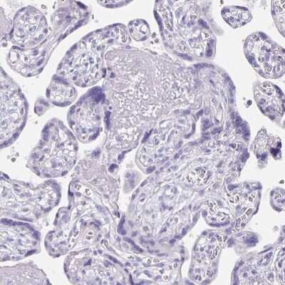 Immunohistochemistry-Paraffin: CFAP74 Antibody [NBP1-91037]