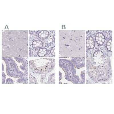 Immunohistochemistry-Paraffin: CFAP74 Antibody [NBP1-91037]