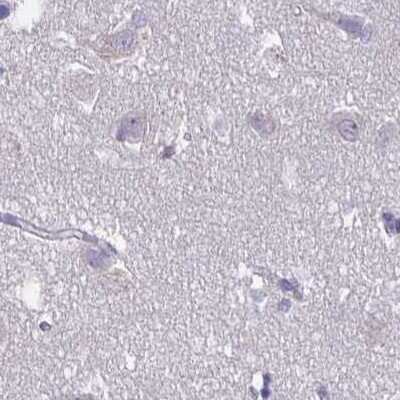 Immunohistochemistry-Paraffin: CFAP74 Antibody [NBP1-91037]