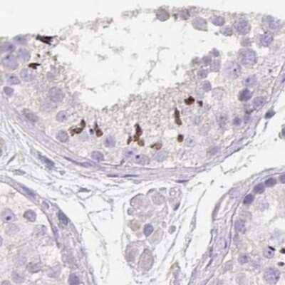 Immunohistochemistry-Paraffin: CFAP74 Antibody [NBP1-91037]