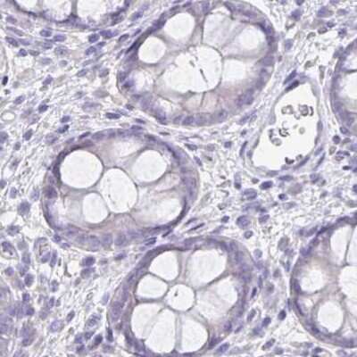 Immunohistochemistry-Paraffin: CFAP74 Antibody [NBP1-91037]