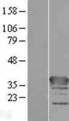 Western Blot: CFAP74 Overexpression Lysate [NBP2-08924]