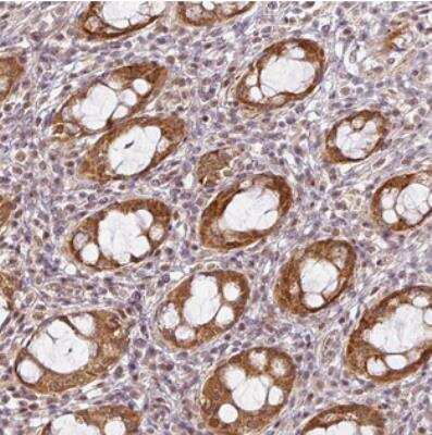 Immunohistochemistry: C1orf226 Antibody [NBP2-30517]