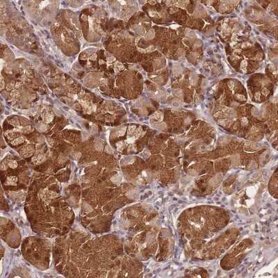 Immunohistochemistry-Paraffin: SPATA45 Antibody [NBP2-14395]