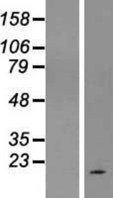 Western Blot: SPATA45 Overexpression Lysate [NBL1-12578]