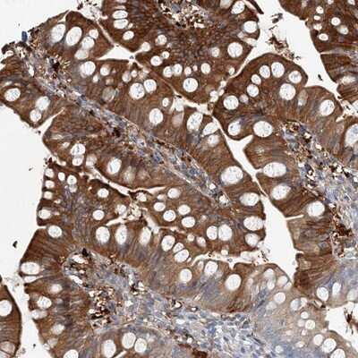 Immunohistochemistry-Paraffin: ARMH1 Antibody [NBP1-93486]