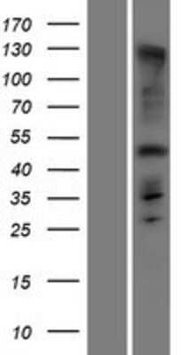 Western Blot: ARMH1 Overexpression Lysate [NBP2-09755]