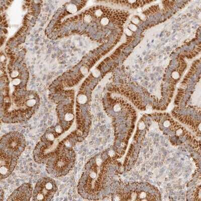 Immunohistochemistry-Paraffin: COA6 Antibody [NBP1-85948]