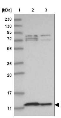 Western Blot: COA6 Antibody [NBP1-85948]