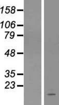 Western Blot: COA6 Overexpression Lysate [NBL1-08318]