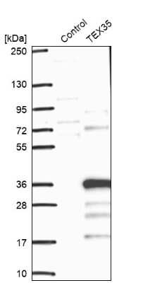 Western Blot: TEX35 Antibody [NBP1-90530]