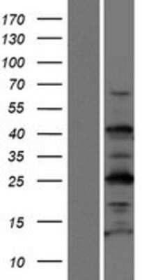 Western Blot: TEX35 Overexpression Lysate [NBP2-06070]