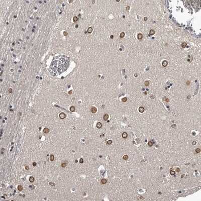 Immunohistochemistry-Paraffin: C1orf50 Antibody [NBP1-81053]