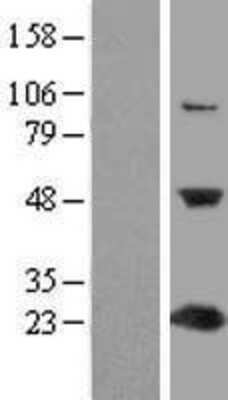 Western Blot: C1orf50 Overexpression Lysate [NBL1-08320]