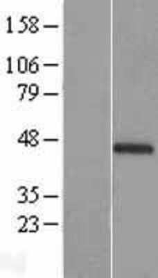 Western Blot: CIART Overexpression Lysate [NBL1-08321]