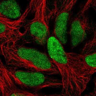 Immunocytochemistry/ Immunofluorescence: C1orf52 Antibody [NBP2-57278]