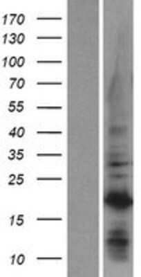 Western Blot: C1orf52 Overexpression Lysate [NBP2-04746]