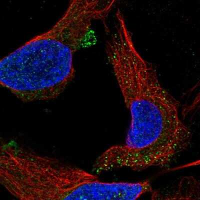 Immunocytochemistry/ Immunofluorescence: C1orf53 Antibody [NBP2-55834]