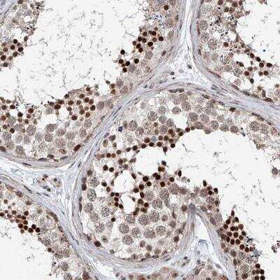 Immunohistochemistry: SDE2 Antibody [NBP1-83503]