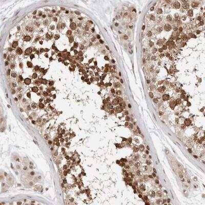 Immunohistochemistry-Paraffin: SDE2 Antibody [NBP1-83504]