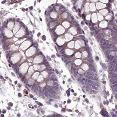 Immunohistochemistry-Paraffin: MENT Antibody [NBP1-82174]