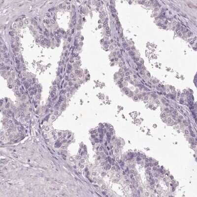 Immunohistochemistry-Paraffin: MENT Antibody [NBP1-82174]