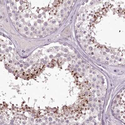 Immunohistochemistry-Paraffin: MENT Antibody [NBP1-82174]