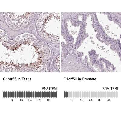 Immunohistochemistry-Paraffin: MENT Antibody [NBP1-82174]