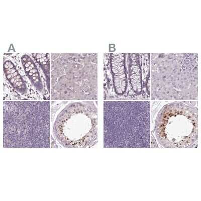 Immunohistochemistry-Paraffin: MENT Antibody [NBP1-82174]