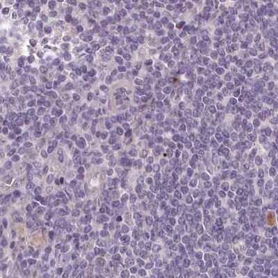 Immunohistochemistry-Paraffin: MENT Antibody [NBP1-82174]