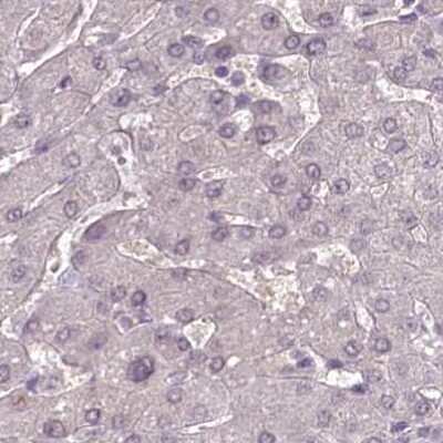 Immunohistochemistry-Paraffin: MENT Antibody [NBP1-82174]