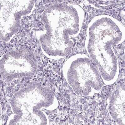 Immunohistochemistry-Paraffin: MENT Antibody [NBP2-32683]